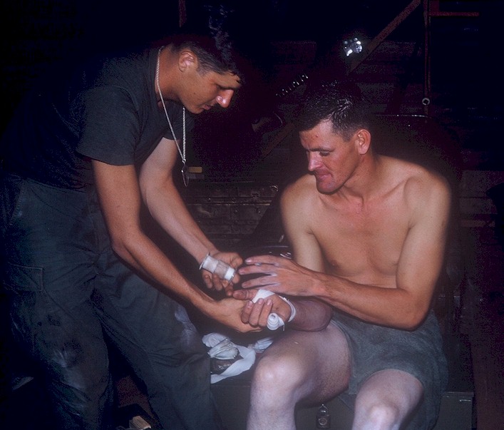 K Troop Medic, George Jones bandages Dave Mansir's Finger.